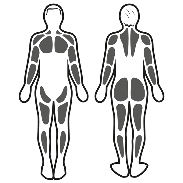 Estimulación muscular