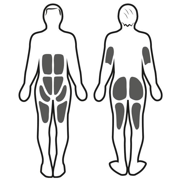 Estimulación muscular