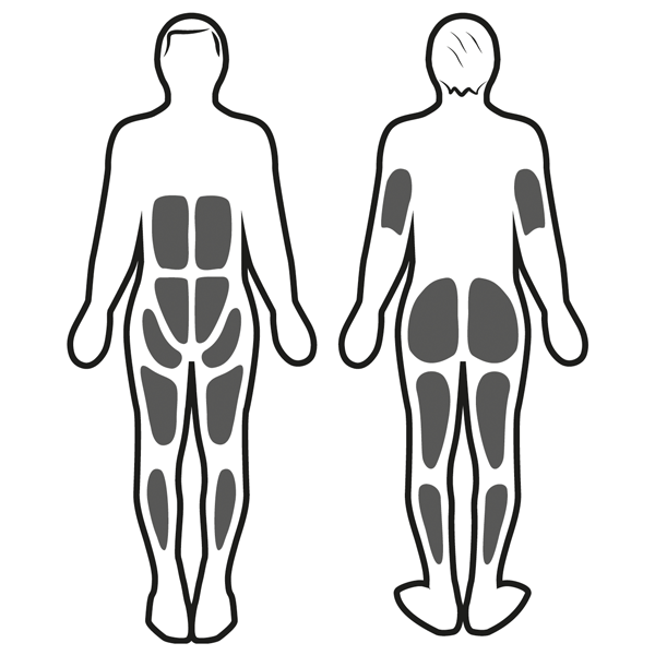 Estimulación muscular