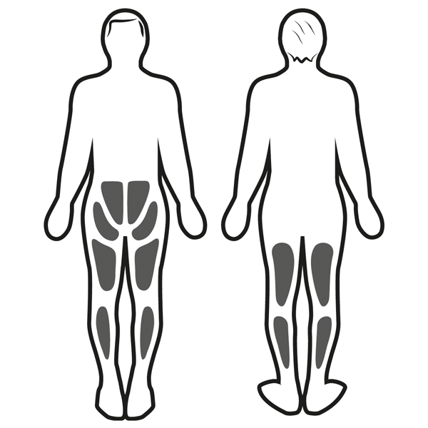 Estimulación muscular